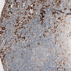 Immunohistochemical staining of human lymph node shows strong cytoplasmic positivity in non-germinal center cells.