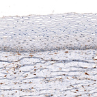 Immunohistochemical staining of human uterine cervix shows no positivity in squamous epithelial cells as expected.