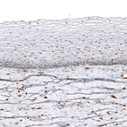 Immunohistochemical staining of human uterine cervix shows no positivity in squamous epithelial cells as expected.