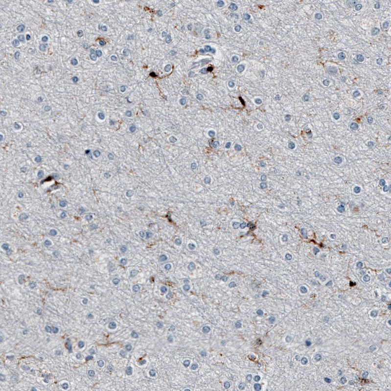 Anti-AIF1 Antibody