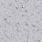 Anti-AIF1 Antibody