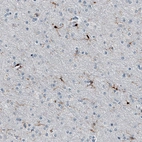 Anti-AIF1 Antibody