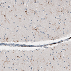 Immunohistochemical staining of human cerebellum shows moderate cytoplasmic positivity in microglia.