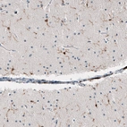 Immunohistochemical staining of human cerebellum shows moderate cytoplasmic positivity in microglia.