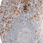 Immunohistochemical staining of human lymph node shows strong cytoplasmic positivity in non-germinal center cells.