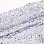 Immunohistochemical staining of human uterine cervix shows no positivity in squamous epithelial cells as expected.
