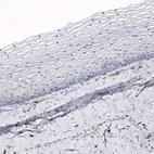 Immunohistochemical staining of human uterine cervix shows no positivity in squamous epithelial cells as expected.