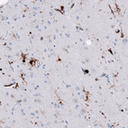 Anti-HLA-DRA Antibody