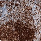 Immunohistochemical staining of human tonsil shows strong membranous positivity in germinal center cells.