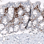 Immunohistochemical staining of human rectum shows strong cytoplasmic positivity in lymphoid cells.