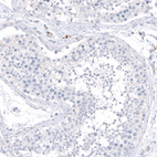 Anti-HLA-DRA Antibody