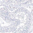 Immunohistochemical staining of human testis shows no positivity in cells in tubules as expected.