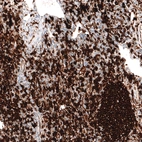 Immunohistochemical staining of human lymph node shows strong membranous positivity in germinal center cells.