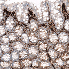 Immunohistochemical staining of human rectum shows strong cytoplasmic positivity in lymphoid cells.