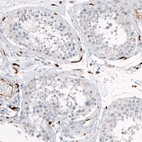 Immunohistochemical staining of human testis shows no positivity in cells in seminiferous ducts as expected.