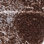 Immunohistochemical staining of human lymph node shows strong membranous positivity in germinal center cells.