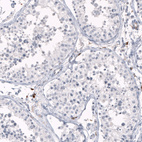 Immunohistochemical staining of human testis shows no positivity in cells in seminiferous ducts as expected.