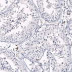 Immunohistochemical staining of human testis shows no positivity in cells in seminiferous ducts as expected.