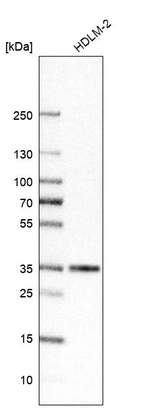 Western blot analysis in human cell line HDLM-2.