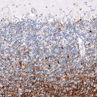Immunohistochemical staining of human cerebellum shows strong cytoplasmic positivity in oligodendrocytes.