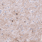 Anti-OPALIN Antibody