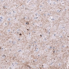 Immunohistochemical staining of human cerebral cortex shows strong positivity in oligodendrocytes and myelinated fibers.