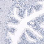 Immunohistochemical staining of human prostate shows no positivity in glandular cells as expected.