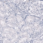 Immunohistochemical staining of human kidney shows no positivity in cells in tubules as expected.