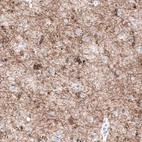 Immunohistochemical staining of human cerebral cortex shows moderate positivity in oligodendrocytes and myelinated processes.
