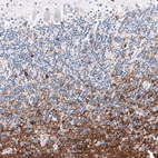 Immunohistochemical staining of human cerebellum shows strong positivity in oligodendrocytes and myelinated fibers.