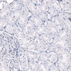 Immunohistochemical staining of human kidney shows no positivity in cells in tubules as expected.