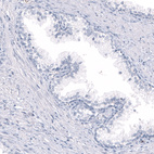 Anti-OPALIN Antibody