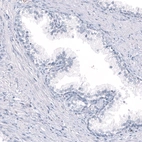 Immunohistochemical staining of human prostate shows no positivity in glandular cells as expected.