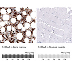 Anti-S100A8 Antibody