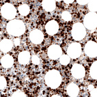Immunohistochemical staining of human bone marrow shows strong cytoplasmic positivity in hematopoietic cells.