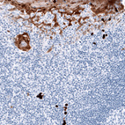 Anti-S100A8 Antibody