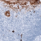 Immunohistochemical staining of human tonsil shows moderate to strong cytoplasmic positivity in squamous epithelial cells.