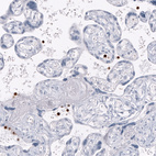 Anti-S100A8 Antibody