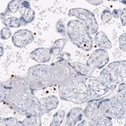 Immunohistochemical staining of human placenta shows strong cytoplasmic positivity in a subset of lymphoid cells.