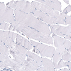 Immunohistochemical staining of human skeletal muscle shows no positivity in myocytes as expected.