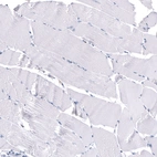 Immunohistochemical staining of human skeletal muscle shows no positivity in myocytes as expected.