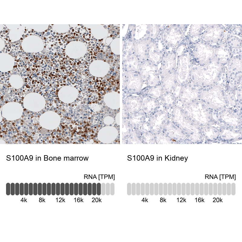 Anti-S100A9 Antibody
