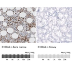 Anti-S100A9 Antibody