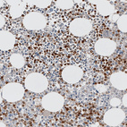 Immunohistochemical staining of human bone marrow shows moderate to strong cytoplasmic positivity in hematopoietic cells.