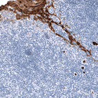 Immunohistochemical staining of human tonsil shows strong cytoplasmic positivity in squamous epithelial cells.