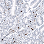 Immunohistochemical staining of human small intestine shows strong cytoplasmic positivity in lymphoid cells.