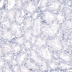 Immunohistochemical staining of human kidney shows no positivity in cells in tubules as expected.