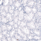 Anti-S100A9 Antibody