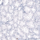 Immunohistochemical staining of human kidney shows no positivity in cells in tubules as expected.