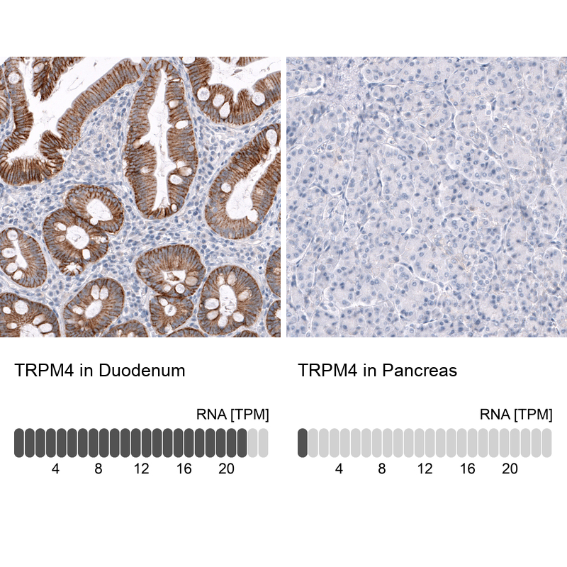 Anti-TRPM4 Antibody